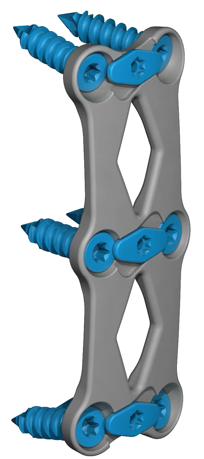 Cervical Spine Plating Solution