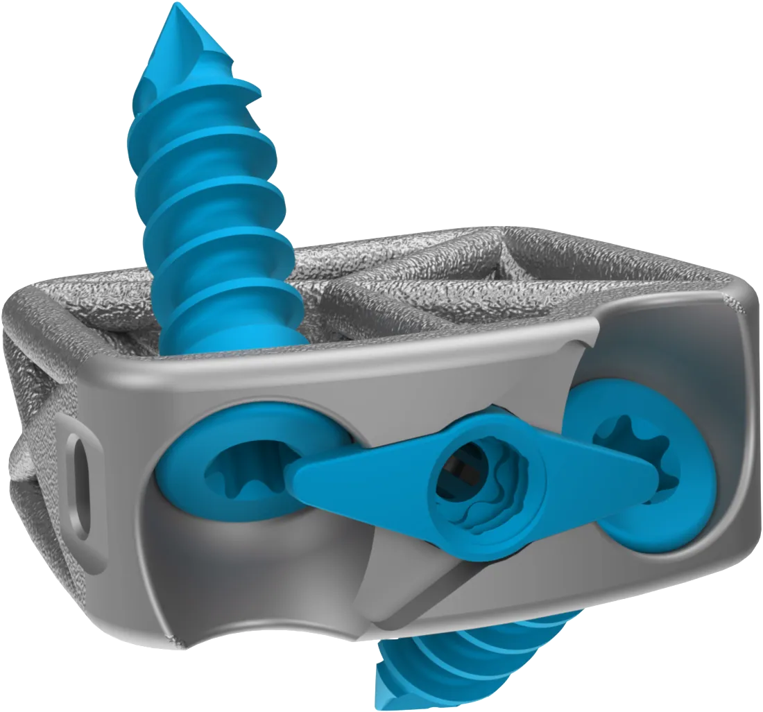 Cervical Spine Truss System™ – Stand Alone